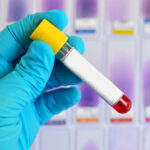 Alzheimer riskini ongoren yeni bir kan testi yolda tam olarak ne zaman hazir olacak I7DMNr2Y